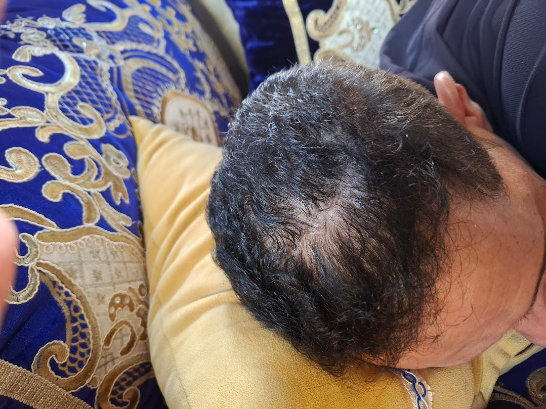 الحل الطبيعي لتقوية الشعر وتقليل التساقط من أول استعمال